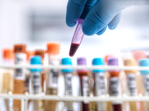 Male researcher holds a blood vial in a medical testing lab