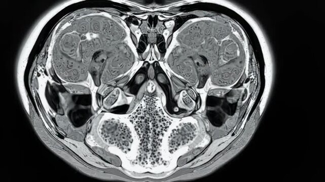 High-resolution MRI scan showcasing detailed head and neck anatomy ideal for medical presentations, educational content, and healthcare marketing materials.