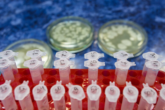 A set of plastic laboratory centrifuge tubes in a red rack in the foreground. Dishes containing bacterial colonies lie on the lab table.
