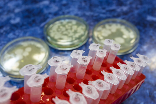 A set of test tubes with biological substances in a red rack held by a scientist against a background of petri dishes on a laboratory bench.
