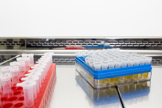 On the metal workbench in the microbiology cabinet are racks of test tubes. A collection of prepared bacterial strains in test tubes.