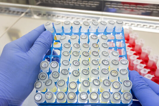 A collection of vaccine samples in small test tubes, placed in individual compartments in a box held by a scientist.
