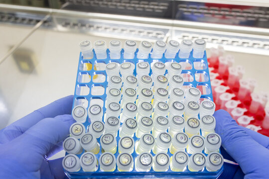 The scientist holds a box containing a set of small test tubes containing sample doses.