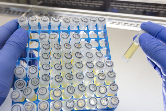 A set of small plastic test tubes with yellow liquid in a cell box, one test tube is held by a scientist with the fingers of his hand in a row.