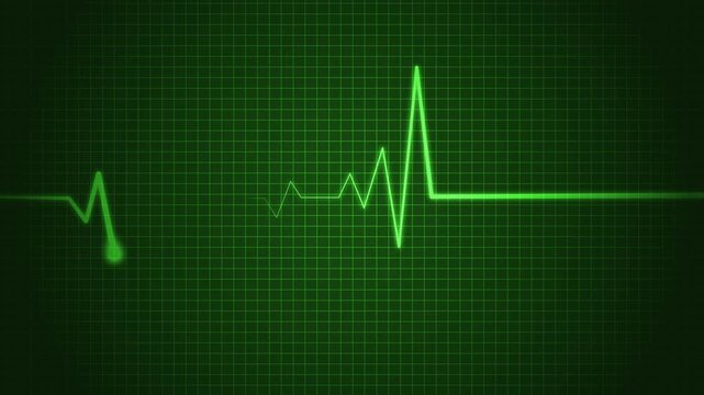 Electrocardiogram Wave Signal Animation for Healthcare Concepts