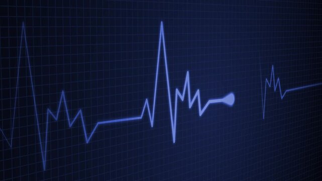 Medical Heart Monitor Animation with Continuous ECG Waveform
