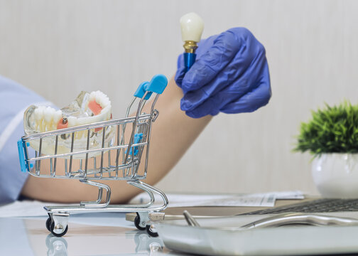 purchasing dental services showing a doctor hand holding an artificial tooth screw near a tiny supermarket trolley in a clinic.