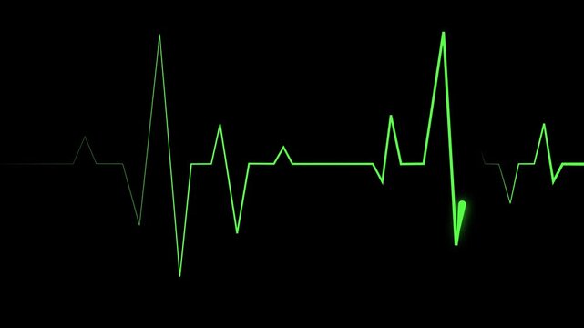 Heartbeat line electrocardiogram style pulse graph with sharp spikes and a minimal medical theme animation