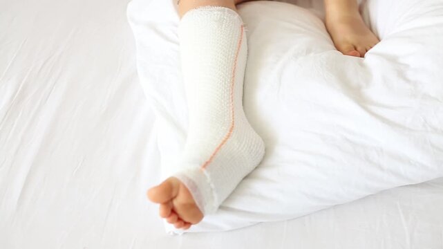 Children's broken leg in orthopedic cast on a white bed in the . Broken leg in cast of an young child