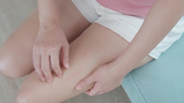 skin problem and beauty. Young woman scratch skin leg has itchy skin from skin allergic, steroid allergy, sensitive skin, red from sunburn, chemical allergy, rash, insect bites, Seborrheic