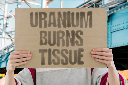 "Uranium burns tissue" Radiological damage occurs from direct exposure. RADIATION. DAMAGE. EXPOSURE. TOXIN. CELLULAR.