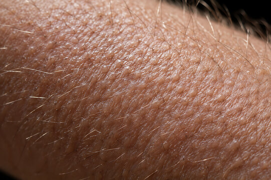 Goosebumps and Raised Hair Follicles on Skin Close Up Showing Textured Surface, Piloerection, Dermatology and Human Skin Anatomy