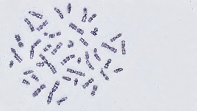 Microscopic view of a human metaphase chromosome spread arranged in a laboratory clinical setting with background genetic analysis isolated pairs chromosomes
