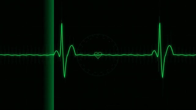 Heartbeat monitor screen showing continuous pulse wave with scanning beam animation on dark background for medical health monitoring clip.
