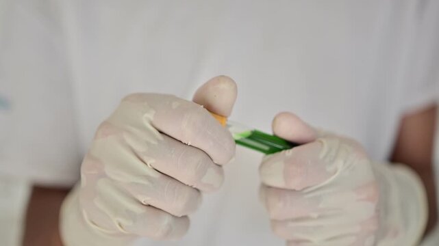 Bile stasis fluid, stagnant biliary fluid retained within the gallbladder or bile ducts, typically thick yellow-green material containing bile acids, bilirubin, cholesterol, mucus, and electrolytes
