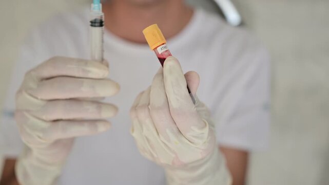 Erythrocyte suspension, a red cellular biological suspension containing red blood cells and hemoglobin dispersed in an aqueous medium, studied in hematology, physiology, and laboratory science

