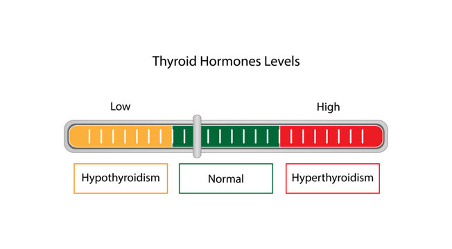 Thyroid function test, Thyroid gland. Hypothyroidism and hyperthyroidism. TSH, T3, T4 hormones. Vector illustration.