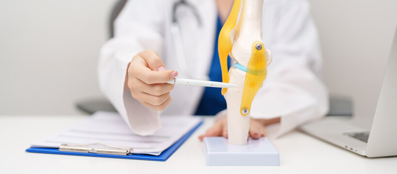 Doctor with Human Knee joint anatomy model. Osteoarthritis, Patellofemoral Pain Syndrome, Patellar Tendinitis, ACL, Anterior Cruciate Ligament, PCL, Posterior, MCL, Medial Collateral, LCL and Lateral