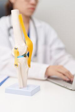 Doctor with Human Knee joint anatomy model. Osteoarthritis, Patellofemoral Pain Syndrome, Patellar Tendinitis, ACL, Anterior Cruciate Ligament, PCL, Posterior, MCL, Medial Collateral, LCL and Lateral