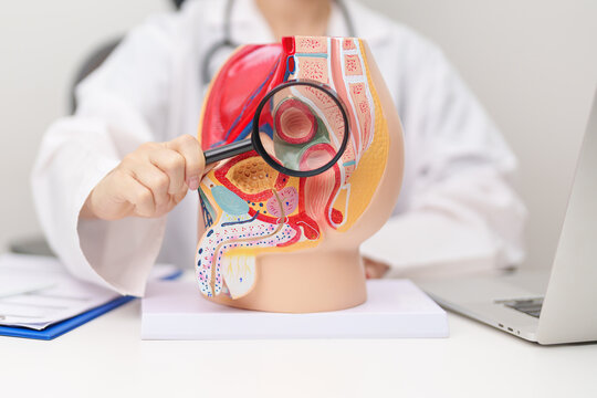 Doctor with Male Reproductive System anatomy model. Male consultation, Prostate Cancer, Enlarged prostate, Prostatitis disease, Male Infertility, Erectile dysfunction, Penis and Male genital disorder
