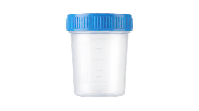 Empty plastic urine specimen container with blue screw cap for lab diagnostic analysis.