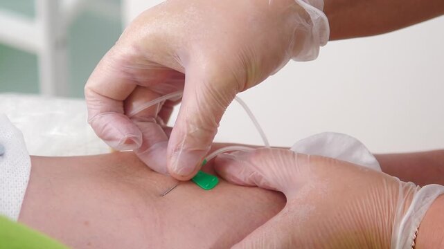 Doctor gloved hands puncturing patient arm vein with needle and green vacutainer tube for blood sample collection. Professional blood draw procedure in modern medical clinic 4k video