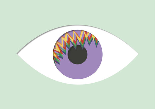Retinal migraine, conceptual illustration
