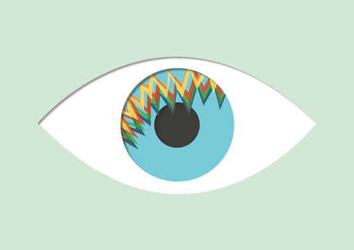 Retinal migraine, conceptual illustration