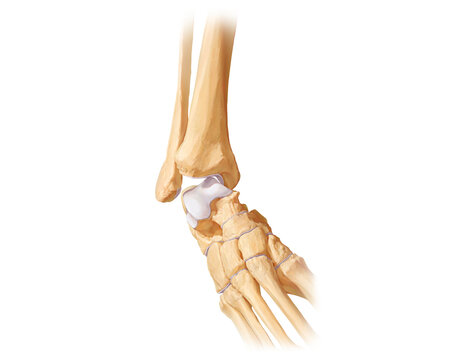 Ankle inversion injury, illustration