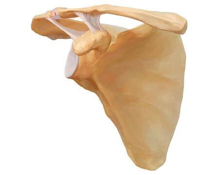 Acromioclavicular dislocation type I, illustration