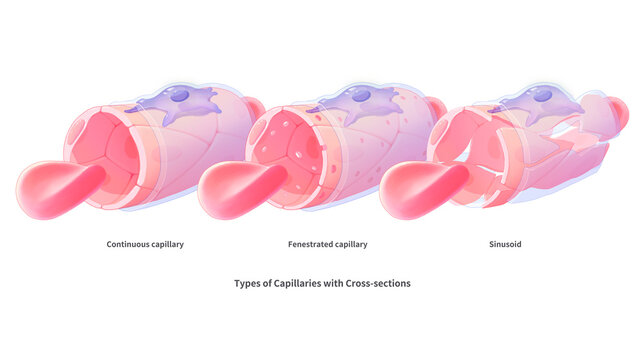 Capillary type, illustration