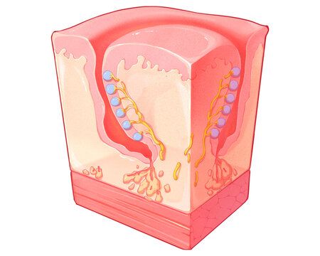 Circumvallate papilla section, illustration