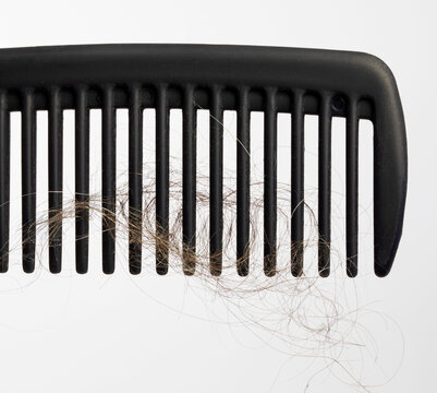 Hair loss, conceptual image