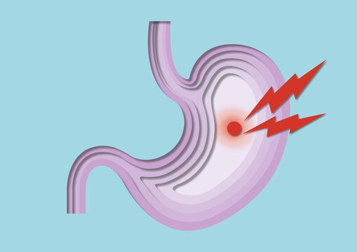 Stomach pain, conceptual illustration