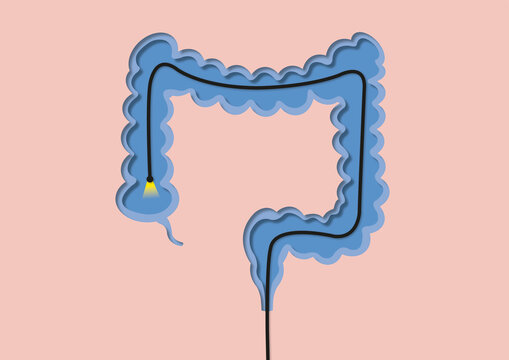 Colonoscopy, conceptual illustration