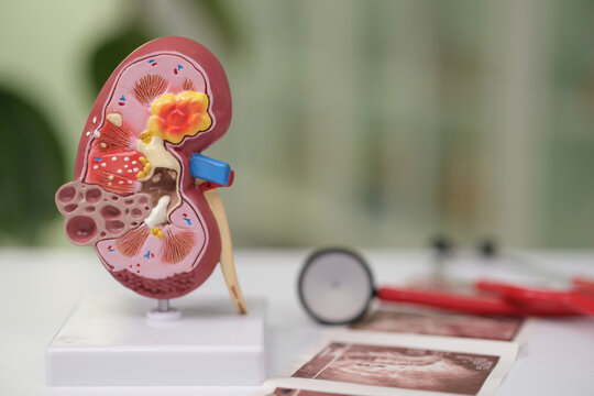 Detailed kidney anatomy model shown on white stand beside blurred medical instruments and scan images on desk, suggesting nephrology education, healthcare training, diagnostics, and medical