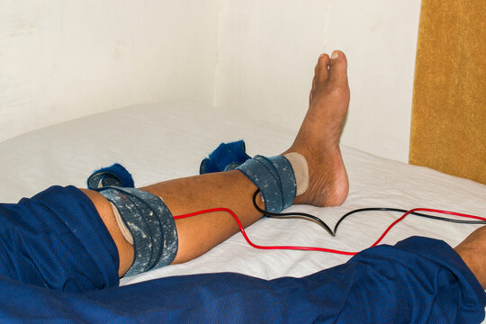 patient&rsquo;s leg during a physiotherapy session, with electrode straps attached around the ankle and below the knee for electrical muscle stimulation therapy