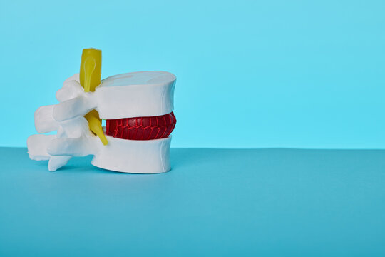 Anatomical spine vertebrae model on physician table. Diagnostics of spinal nerve compression and osteochondrosis.