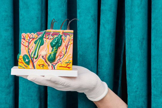 Gloved hand holding anatomical cross section model of human skin layers and hair follicles. Dermatology diagnostic consultation and eczema treatment.