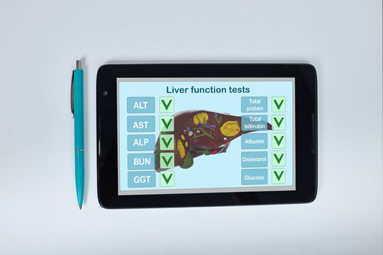 Tablet computer lying next to a ballpoint pen displaying a liver function tests list. Hepatic laboratory diagnostics and enzyme screening concept