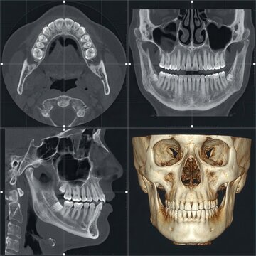 Detailed Dental And Skull Scans For Medical Research And Dental Planning