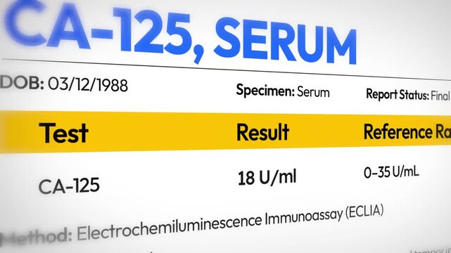 Close up 4k footage of CA-125 serum blood test results with medical data and reference range on white background design