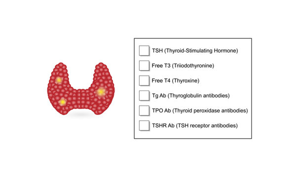 Thyroid disorders. Thyroid function test, TSH, T3 and T4 hormones. Thyroglobulin, Thyroid peroxidase and TSH receptor antibodies. Hypothyroidism and hyperthyroidism.