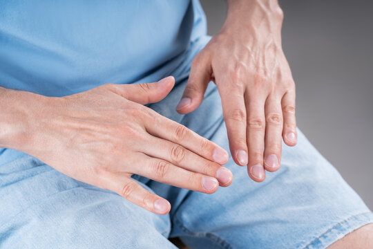 Men hands in close up, palms down top view. Pain in the arms, tremor, gout.
