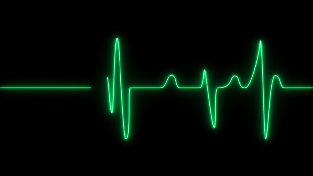 A bright green glowing neon heartbeat line, representing an ekg or ecg pulse, isolated on a solid black background, for medical concepts