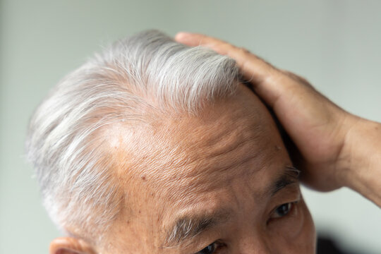 forehead closeup of elderly asian man touching his grey hair with thoughtful expression,  indoor soft natural window light