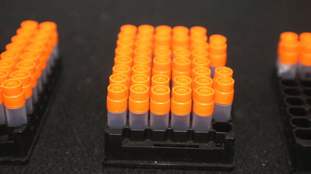 Laboratory plastic vials with orange screw caps in storage racks