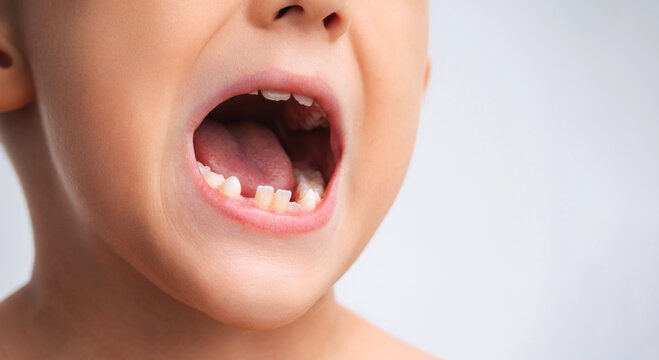 child's lost baby teeth in closeup. Pediatric dentistry and dental care for children. The concept of pediatric dentistry, the replacement of baby teeth for permanent teeth on white isolated background