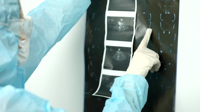 Doctor Pointing At Brain MRI Xray Scan Film. Medical Diagnostics Radiologist Examination 