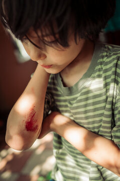 A sad boy looks at a bleeding wound on his arm